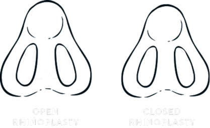 Open vs Open Rhinoplasty Diagram