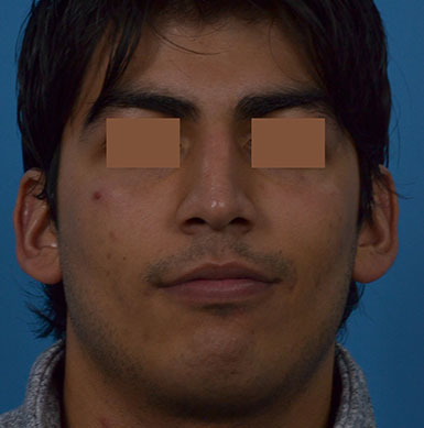 Before